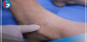 Hospital Rebagliati reporta 60,000 casos asociados a trombosis en los últimos seis meses 