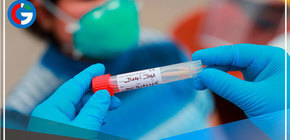 Perú reporta 578 contagios y 9 fallecidos en 24 horas