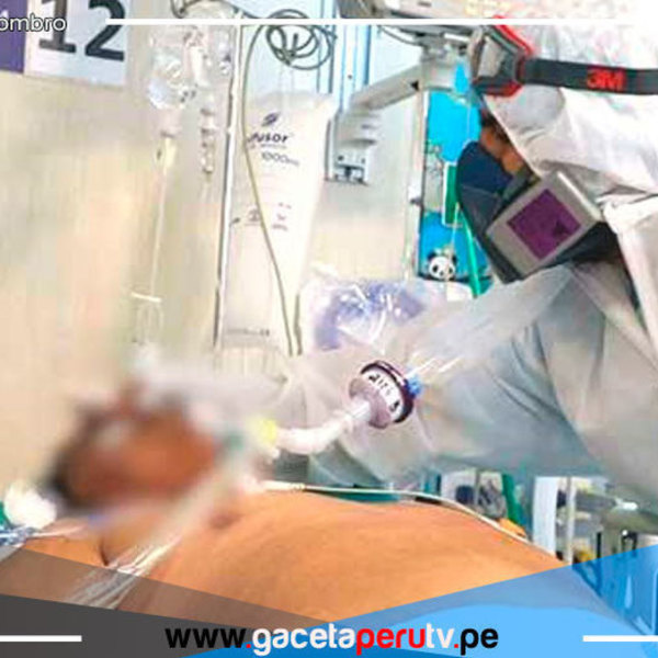 Lima: Hospital Loayza atendió más de 2,000 pacientes en UCI durante el 2021 