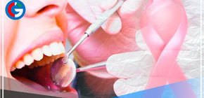 Existe una relación directa entre la salud bucodental y el cáncer de mama