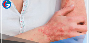 E.E.U.U.: Nueva York declara el estado de emergencia