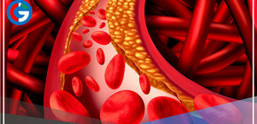 Sepa ¿Qué se debe tomar para bajar los triglicéridos?