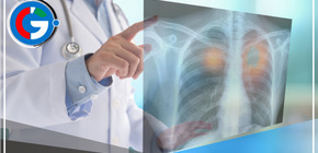 DxScope: La IA que detecta enfermedades respiratorias a través de sonidos