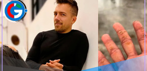 Enfermedad de Julián Zucchi: ¿Por qué no puede tocar a sus hijos sin guantes?