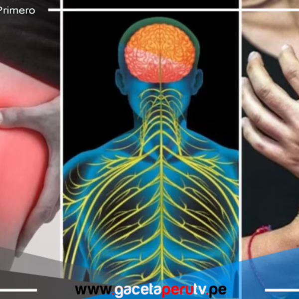 Minsa alerta que sí tratamiento para el síndrome Guillain-Barré pero no hay cura