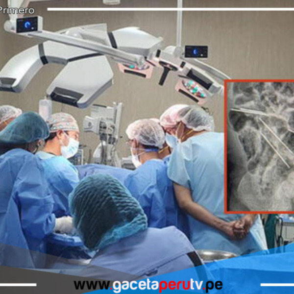 Médicos salvan la vida de menor que consumió ocho agujas