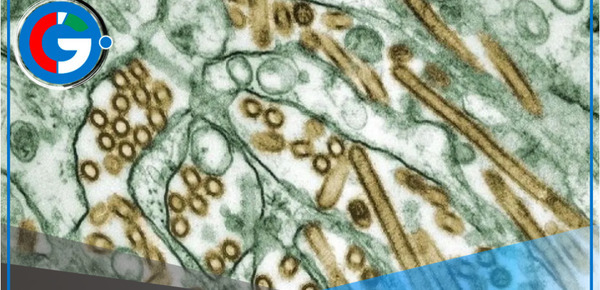 Cuatro personas infectadas con H5N1 en EE.UU.: OMS lanza alerta mundial