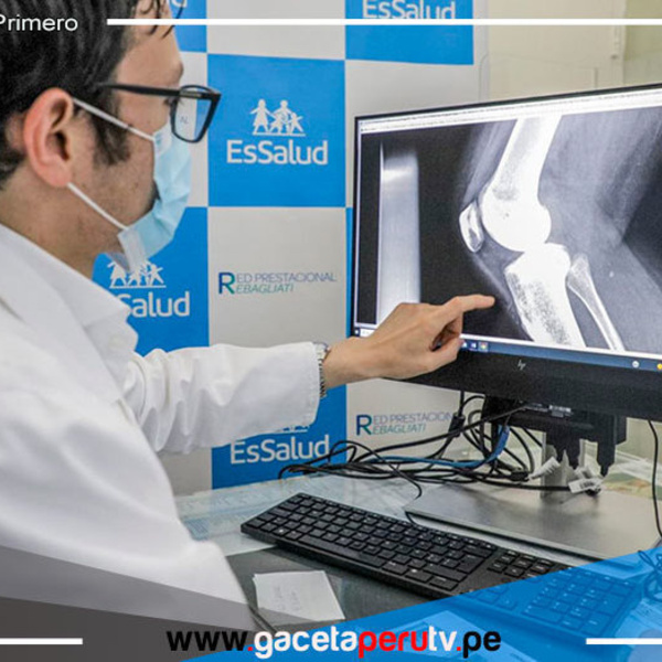 Realizan más de 80,000 atenciones a pacientes con osteoporosis a nivel nacional 