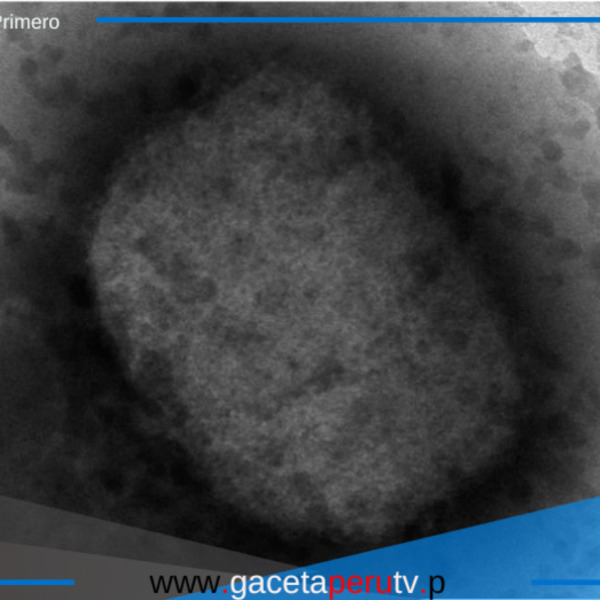 Alerta en Alemania por primer caso de nueva variante de mpox
