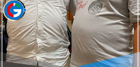 Aproximadamente 15 millones de peruanos sufren de obesidad