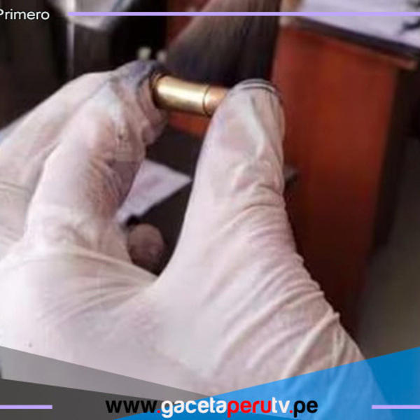 VMT: delincuentes balean a docente por resistirse al robo de su cartera