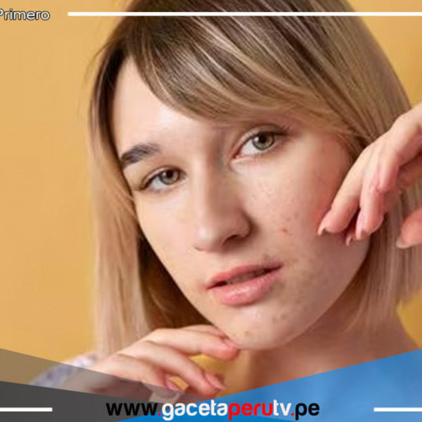Cambios de estación afectan la salud de la piel