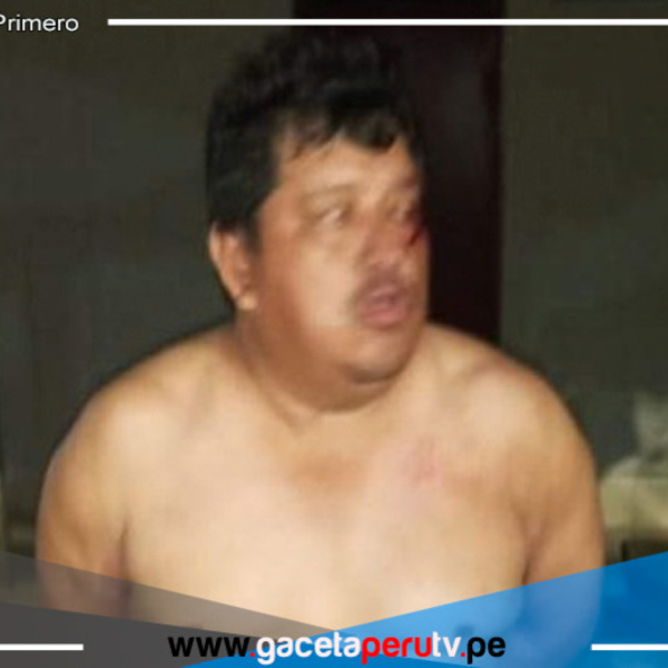 Investigan presunto intento de feminicidio en hotel de Loreto