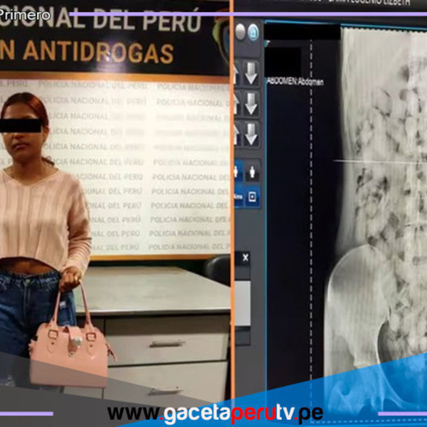 Capturan a joven burrier que intentaba transportar droga en el estomago 