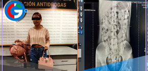 Capturan a joven burrier que intentaba transportar droga en el estomago 