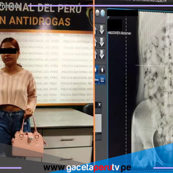 Capturan a joven burrier que intentaba transportar droga en el estomago 