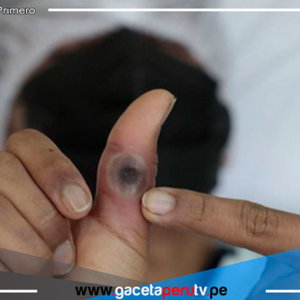 Viruela del Mono:  ¿Cuáles son sus síntomas y cómo se evita? 