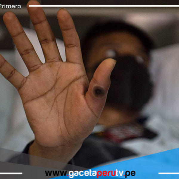 Piden 135 millones de dólares al mundo para frenar brotes de mpox en África 