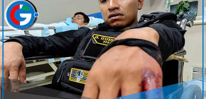 Tres serenos atacados gravemente en operativo municipal de Comas