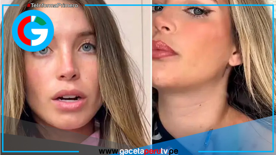 Flavia Laos confiesa que le detectaron enfermedad autoinmune que no tiene cura