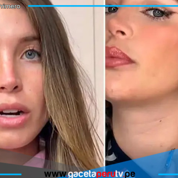 Flavia Laos confiesa que le detectaron enfermedad autoinmune que no tiene cura