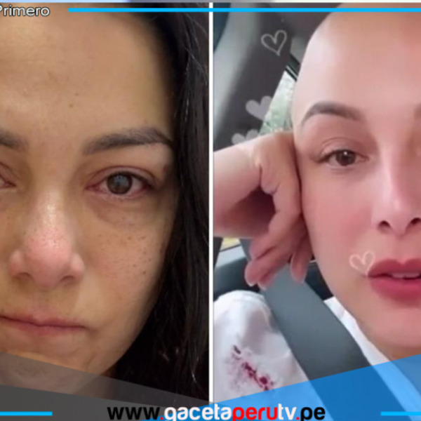 Natalia Salas revela que el cáncer regresó a su cuerpo nuevamente