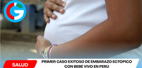 Primer caso exitoso de embarazo ectópico con bebé vivo en Perú