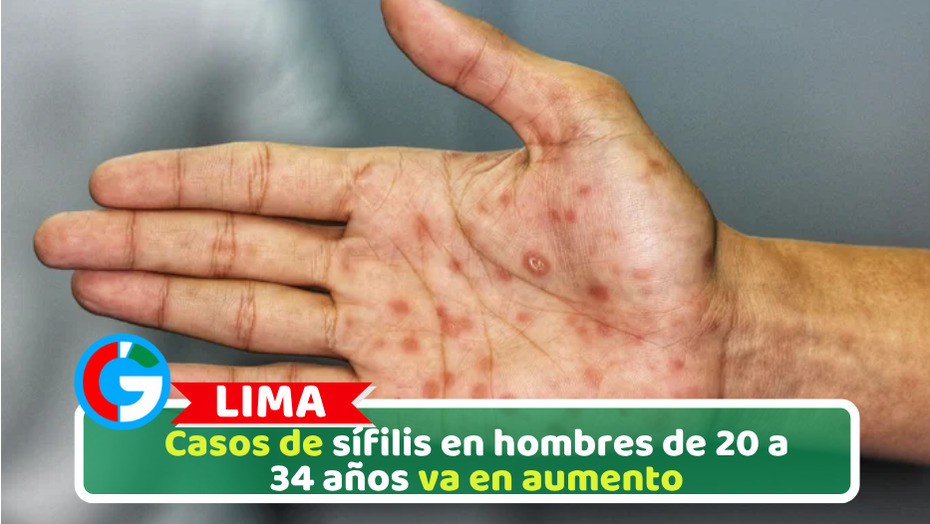 Casos de sífilis en hombres de 20 a 34 años va en aumento